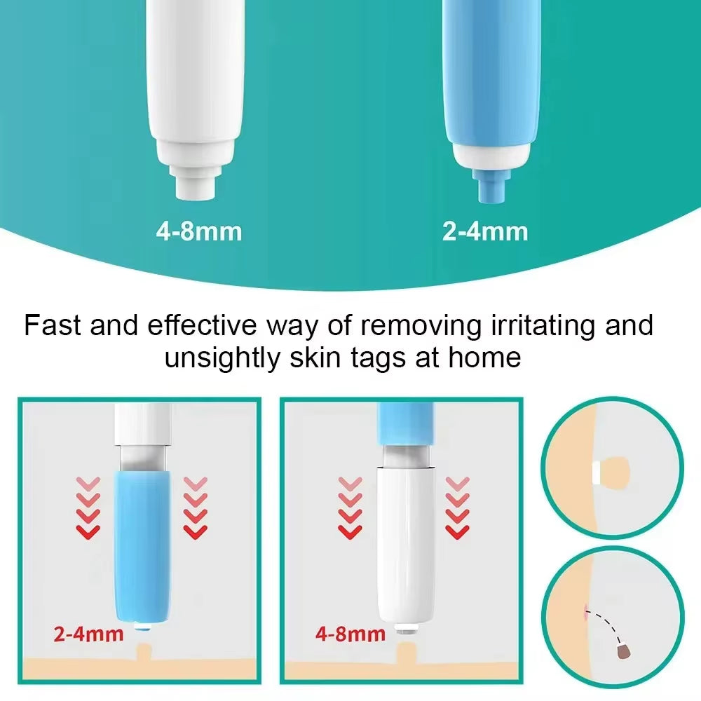 Skin Tag Removal Tool Rubber Rings Face Beauty Accessories Skin Tag Removal Device Multipurpose Supplies for Face Neck Chin Back