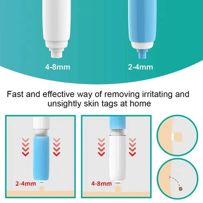 Skin Tag Removal Tool Rubber Rings Face Beauty Accessories Skin Tag Removal Device Multipurpose Supplies for Face Neck Chin Back
